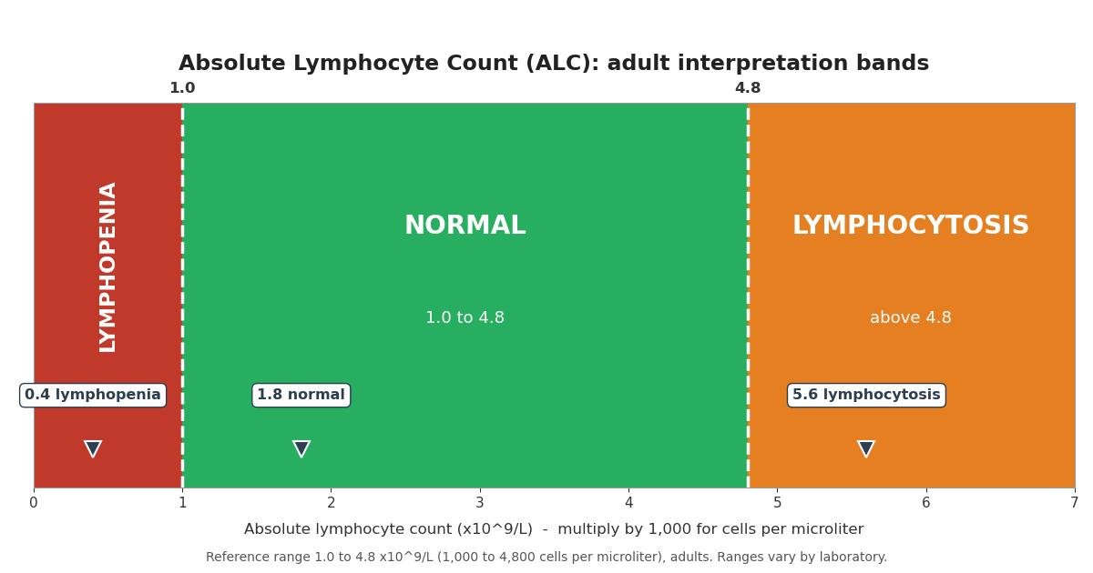 Chart of absolute lymphocyte count interpretation bands for adults: lymphopenia below 1.0, normal from 1.0 to 4.8, and lymphocytosis above 4.8 x10^9 per liter, with example values marked