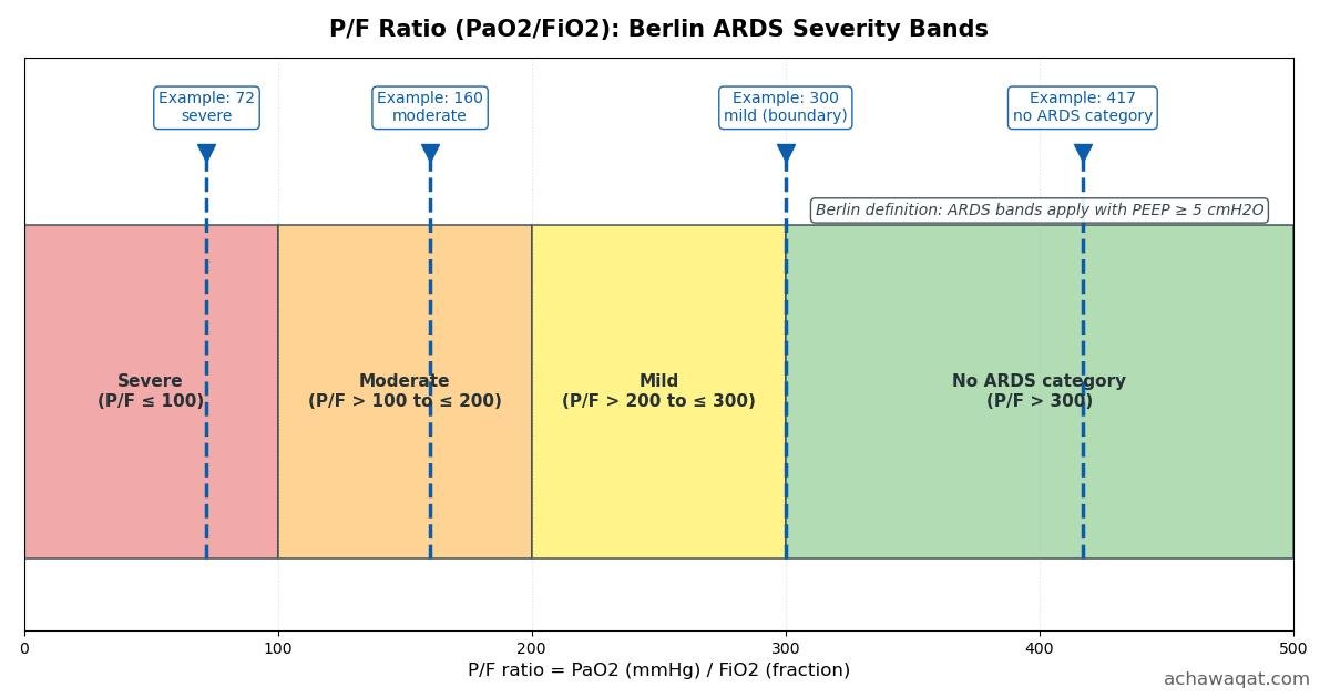 P/F Ratio (PaO 2 /FiO 2 ) Calculator reference chart