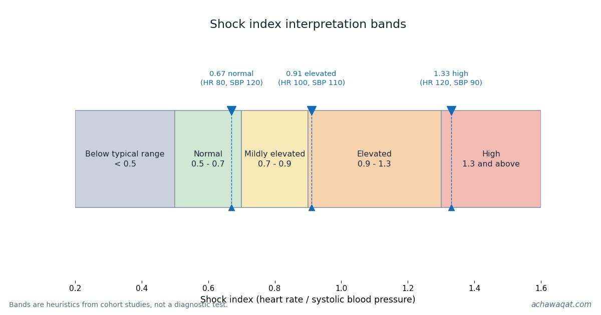 Chart of shock index interpretation bands from 0.2 to 1.6, with example markers at 0.67 (normal), 0.91 (elevated) and 1.33 (high)